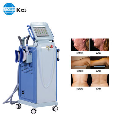 10.4 TFT販売の不凍剤の膜のための縦の細く機械ベスト セラーのcryolipolysis機械